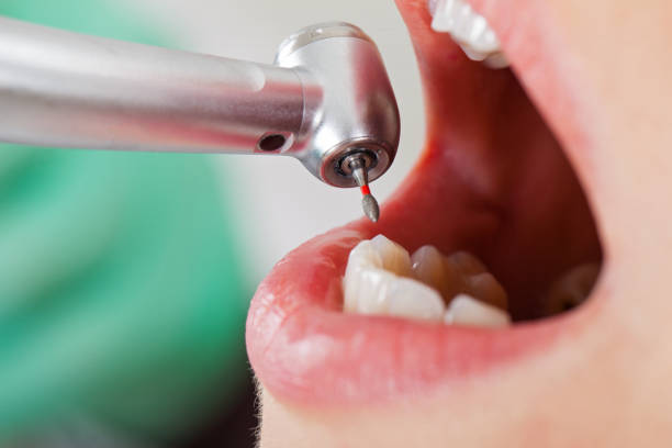 Best Emergency Dental Care for Sports Injuries in Williamston, SC